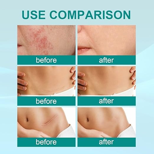 South Moon Scar Spray